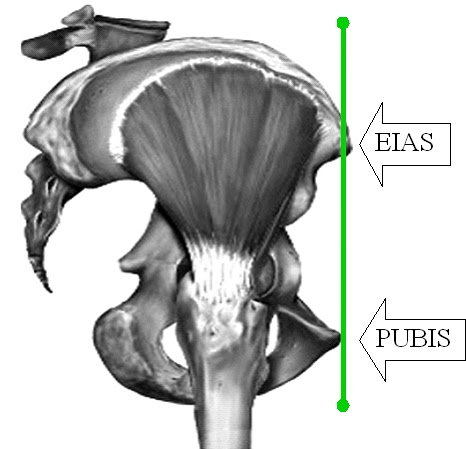 pelvis neutra